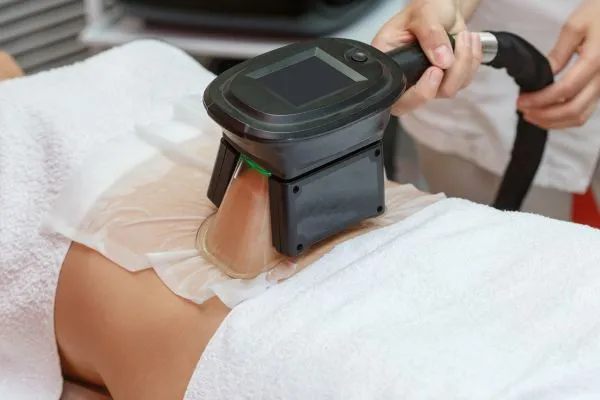 Image of person having fat freezing treatment to help weight gain Croydon
