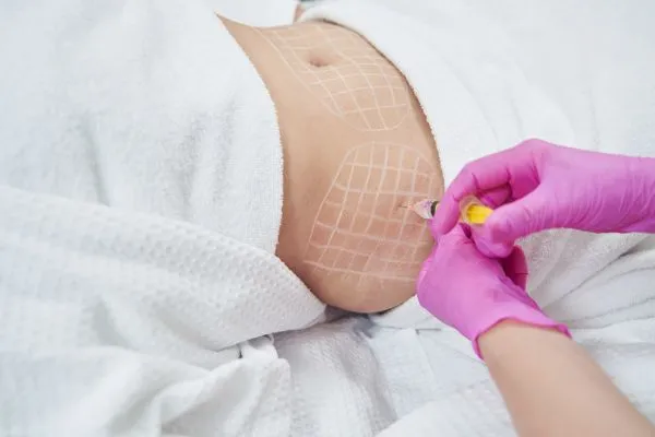 image of fat dissolving injections on love handles to help combat weight gain Croydon