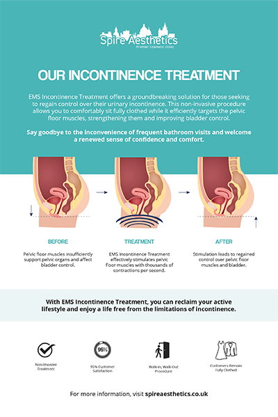 image to show how EMS treatment works for female urinary incontinence Croydon