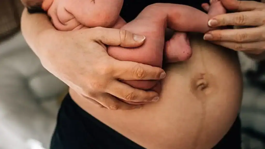 Why Is My Stomach Still Big After Pregnancy Croydon?